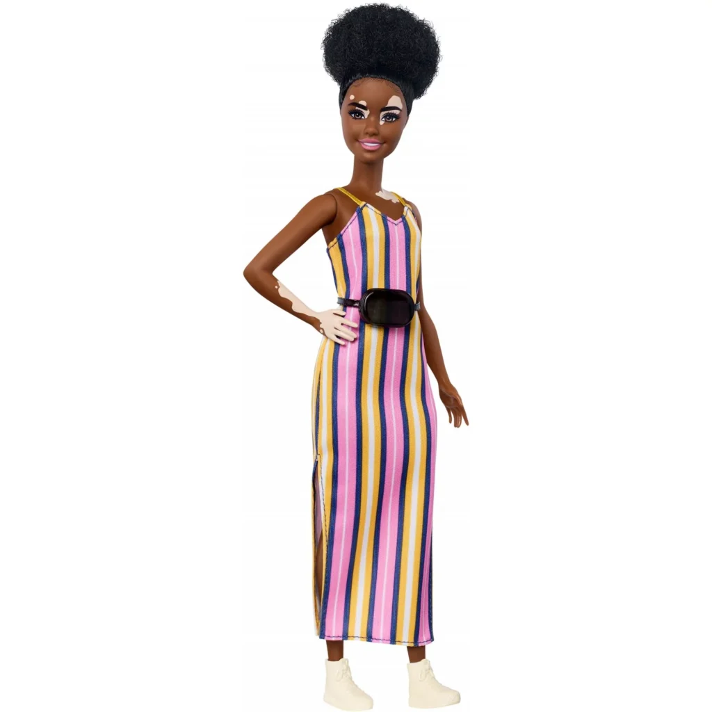 Barbie Fashionistas Doll with Vitiligo and Curly Brunette Hair